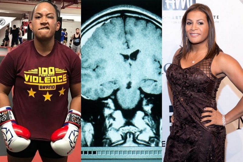 When transgender fighter Fallon Fox broke her opponent's skull in MMA fight