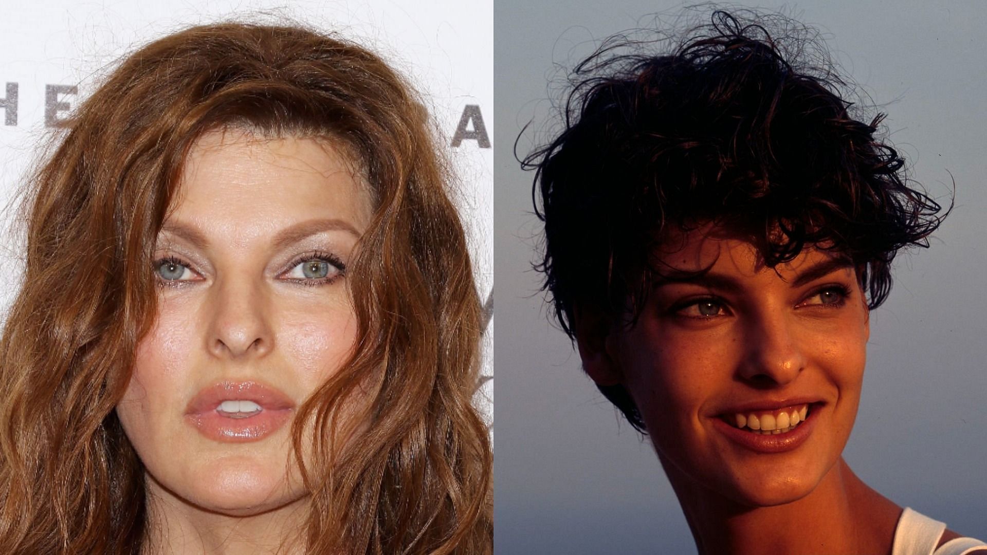 What happened to Linda Evangelista? Model shares before and after