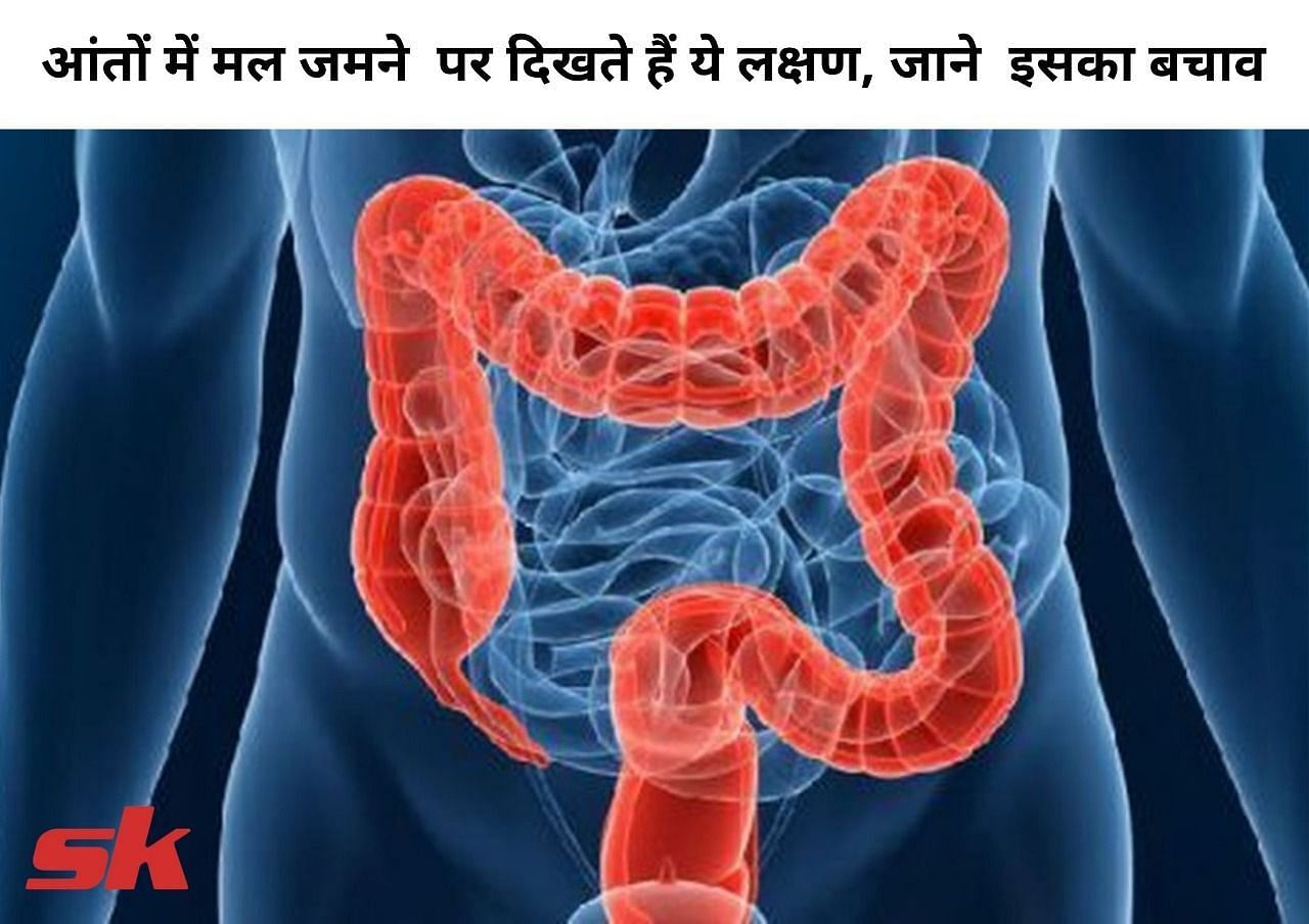 आंतों में मल जमने पर दिखते हैं ये लक्षण, जाने इसका बचाव (फोटो - sportskeeda hindi)