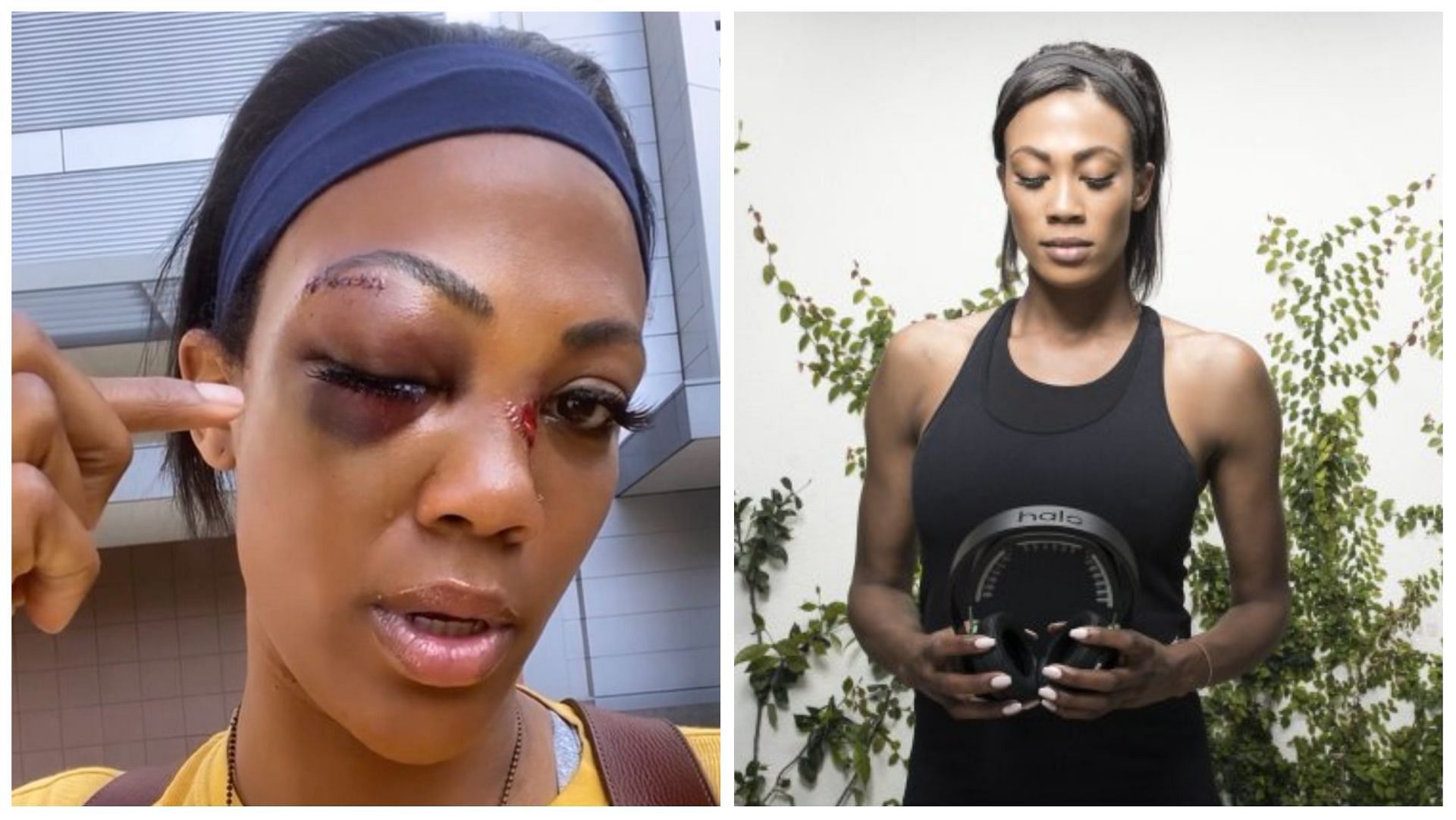 Homeless man charged with assault for attacking Olympian Kim Glass with metal pipe (Image via Twitter/KimGlass)