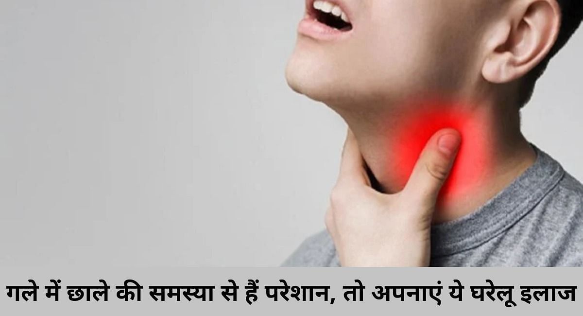 गले में छाले की समस्या से हैं परेशान, तो अपनाएं ये घरेलू इलाज(फोटो-Sportskeeda hindi)