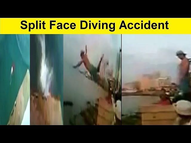 Reddit: Split face diving accident post resurfaces online