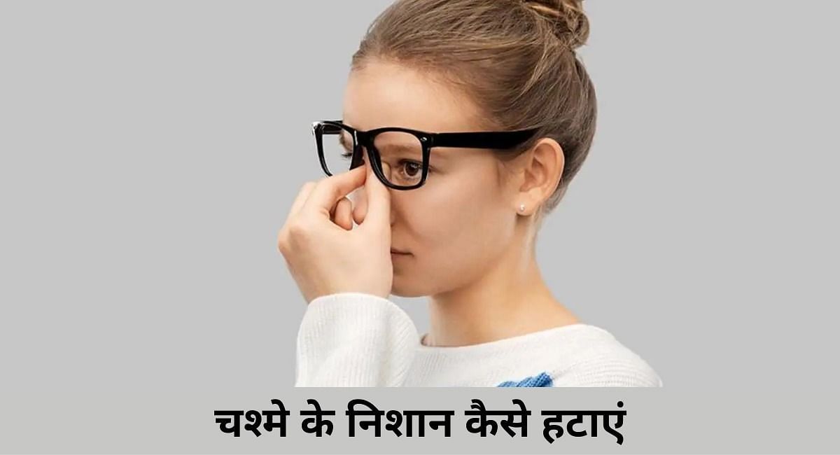 चश्मे के निशान कैसे हटाएं (फोटो - sportskeeda hindi)