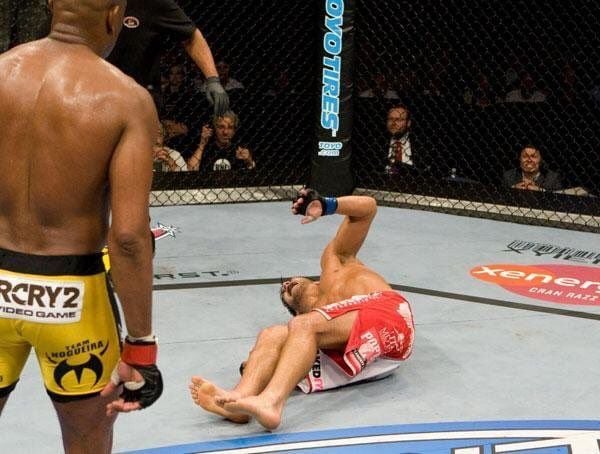 Defensive Injuries Fight T.J. Dillashaw, Anderson Silva and more: 5 UFC fighters who suffered ...