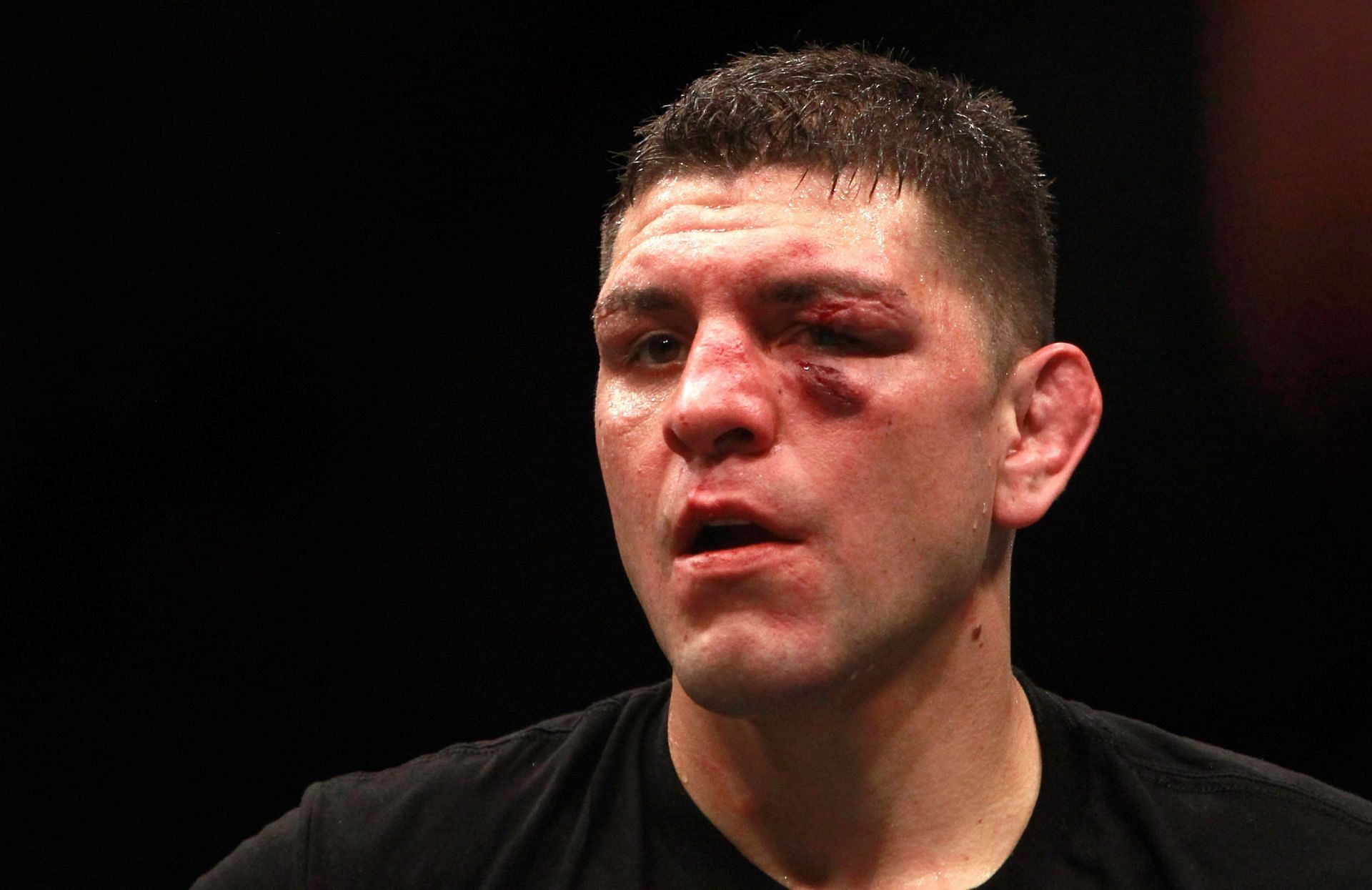 Nick Diaz&#039;s star power has made him a viable headliner despite his lack of victories
