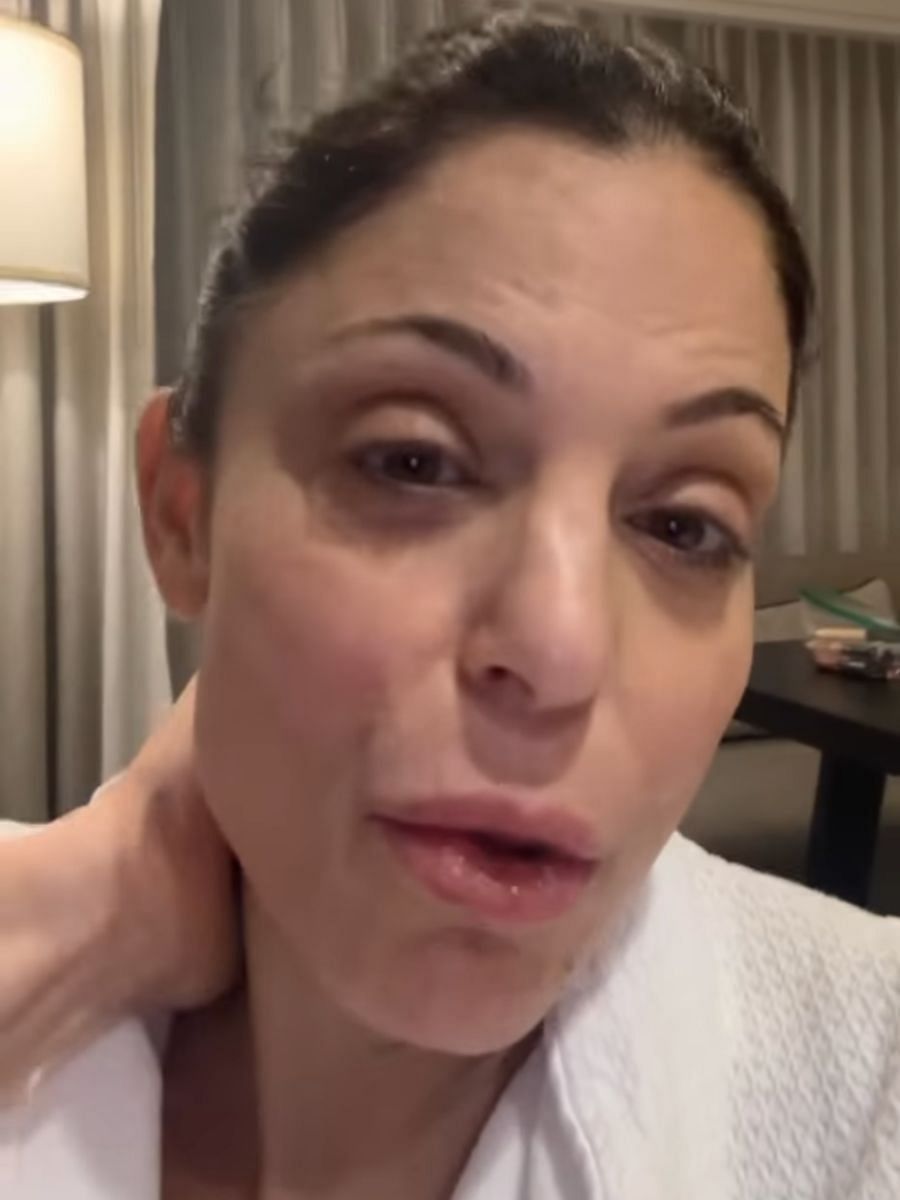 What happened to Bethenny Frankel’s face? RHONY alum reveals she’s “not