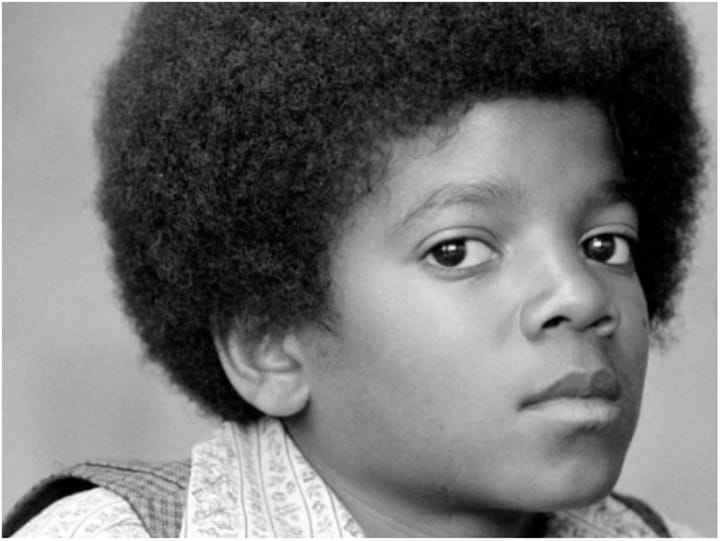 Did Michael Jackson Bleach His Skin? Star’s Skin Condition Explored