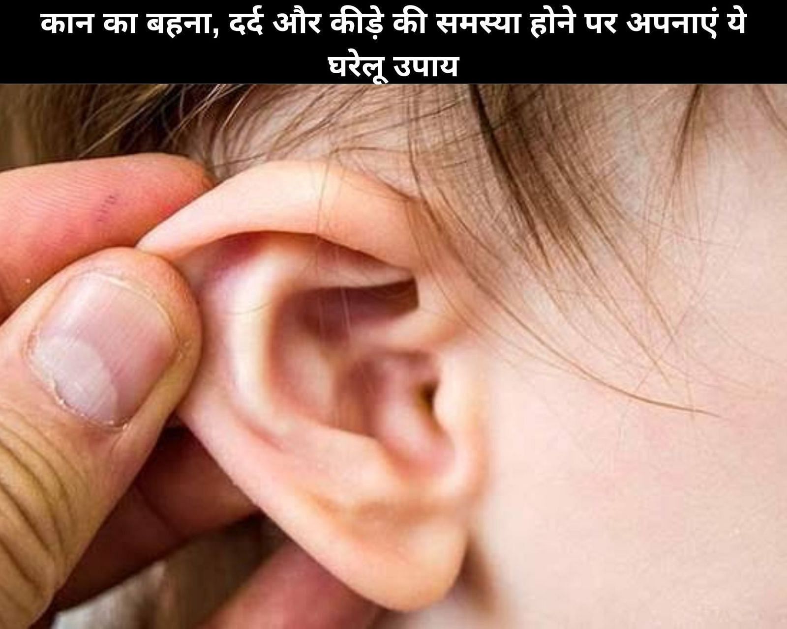 कान का बहना, दर्द और कीड़े की समस्या होने पर अपनाएं ये 7 घरेलू उपाय (फोटो - sportskeedaहिन्दी)