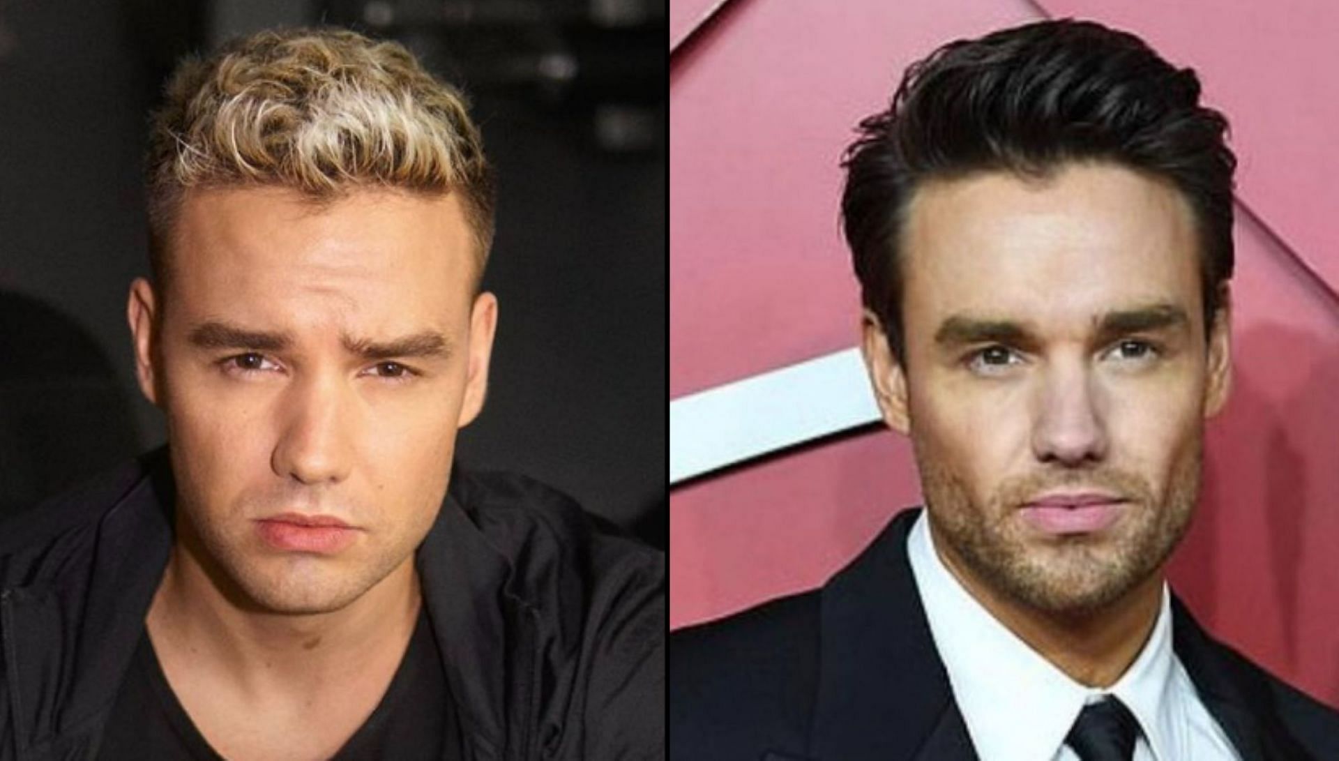 Liam Payne buccal fat removal claim surfaces as before and after pictures go viral