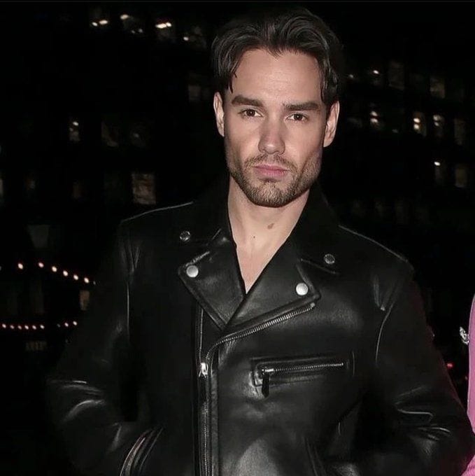 Liam Payne buccal fat removal claim surfaces as before and after