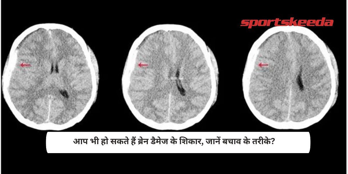 You can also be a victim of brain damage, know the methods of rescue?