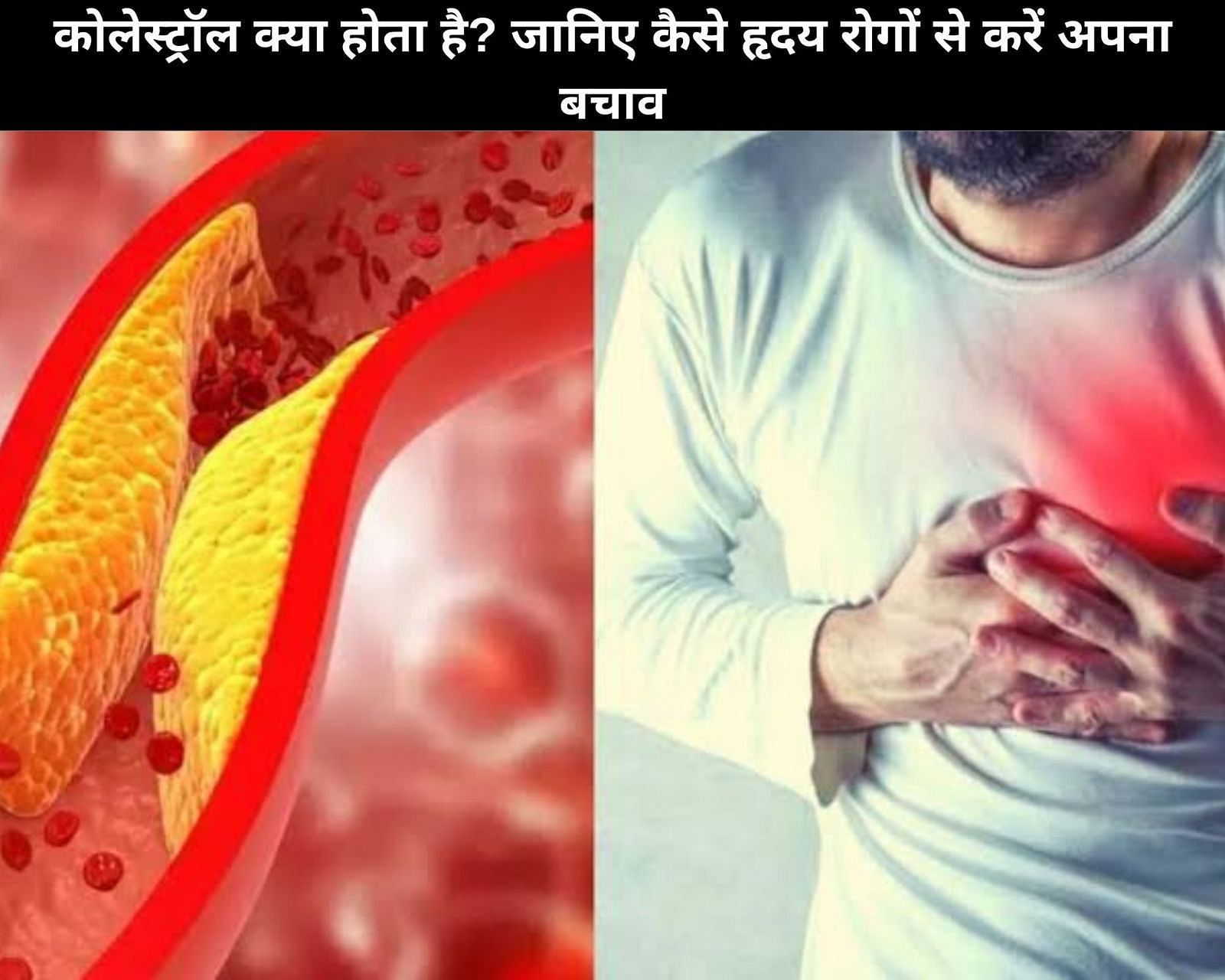 कोलेस्ट्रॉल क्या होता है? जानिए कैसे हृदय रोगों से करें अपना बचाव (फोटो - sportskeedaहिन्दी)