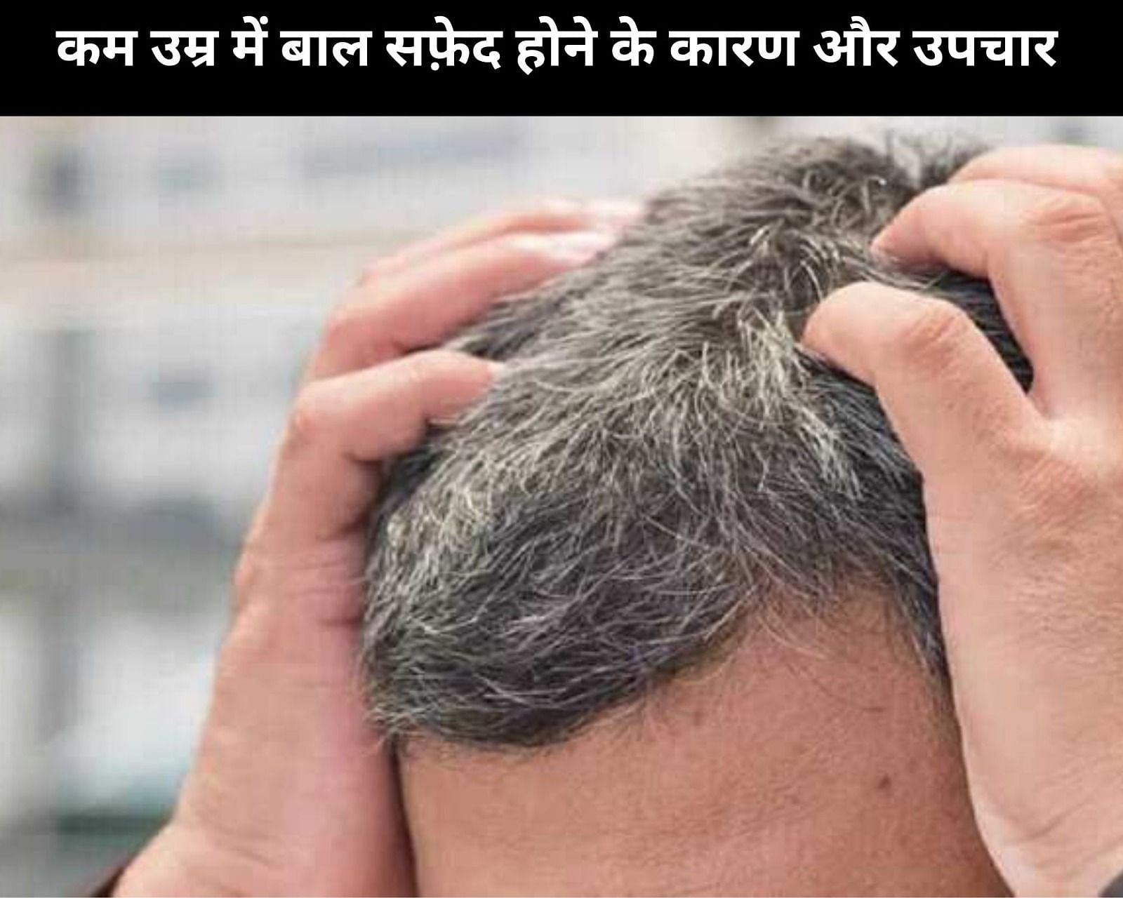 कम उम्र में बाल सफ़ेद होने के 5 कारण और उपचार (फोटो - sportskeedaहिन्दी)