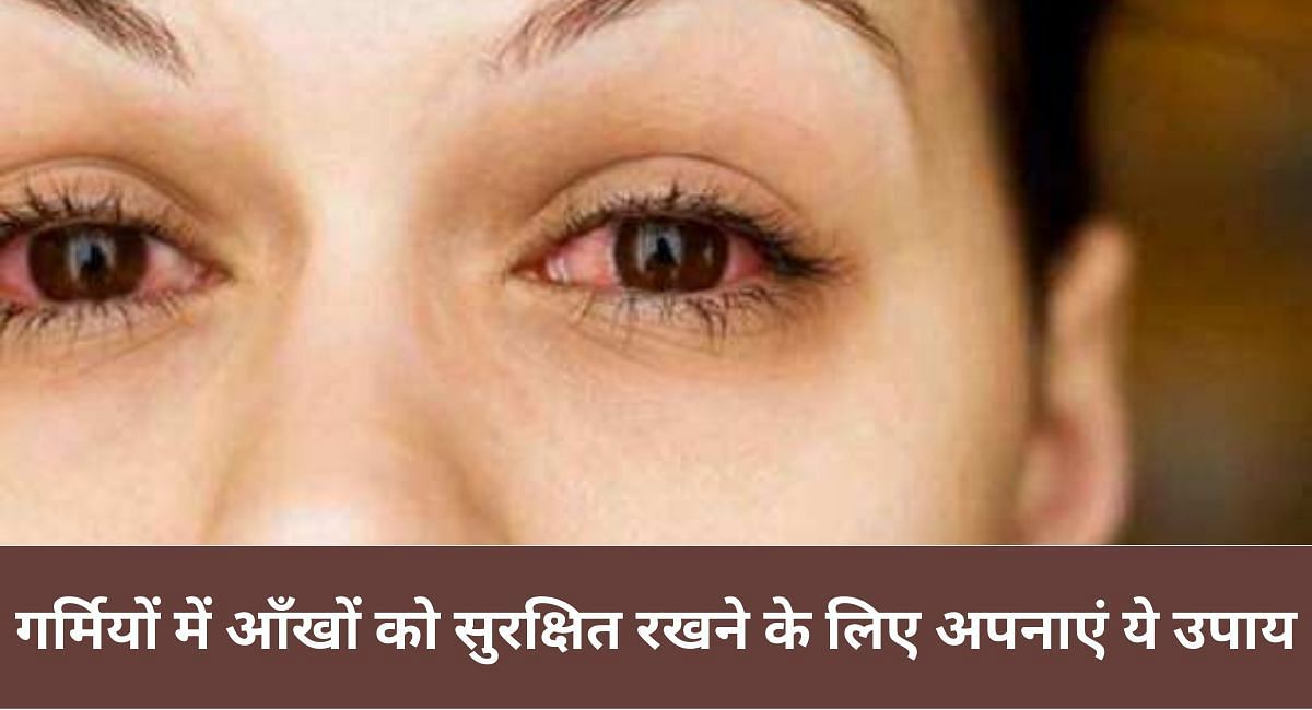 गर्मियों में आँखों को सुरक्षित रखने के लिए अपनाएं ये उपाय 