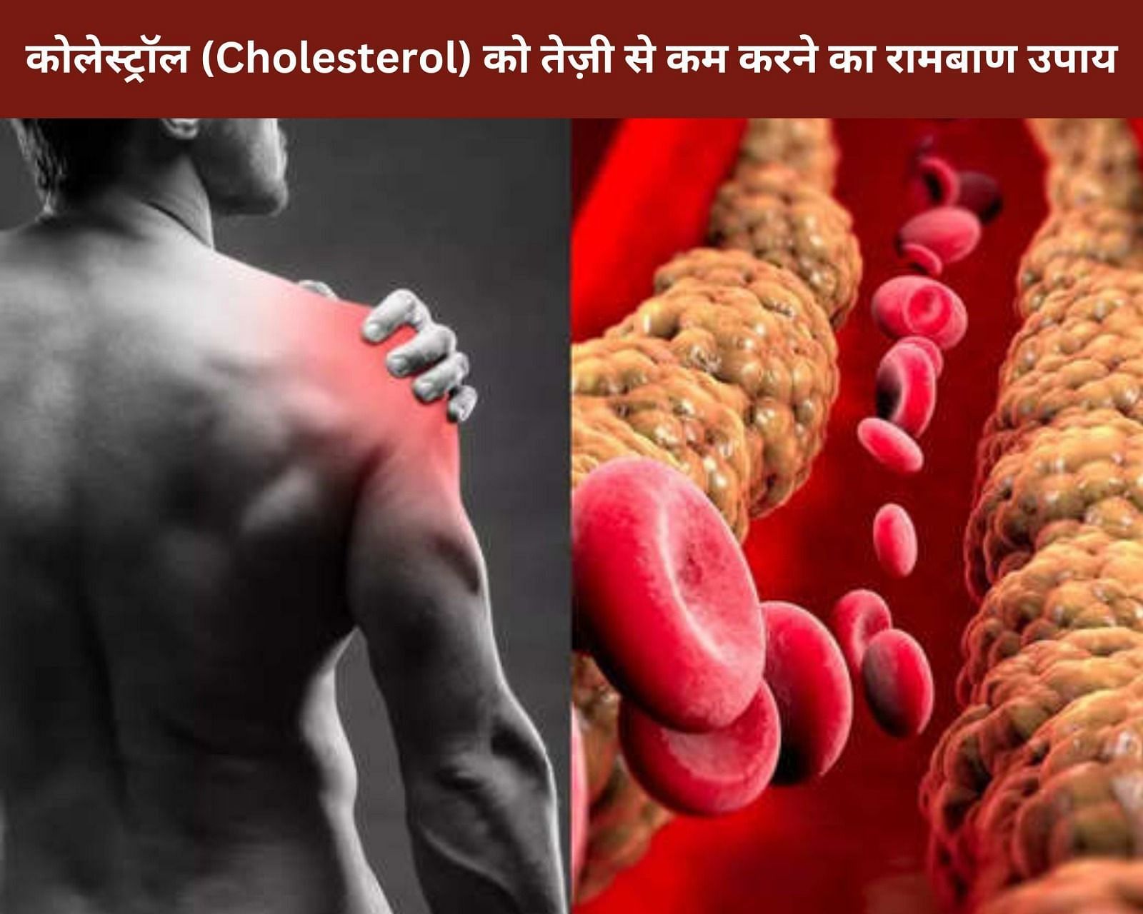 कोलेस्ट्रॉल (Cholesterol) को तेज़ी से कम करने का रामबाण उपाय (फोटो - sportskeedaहिन्दी)