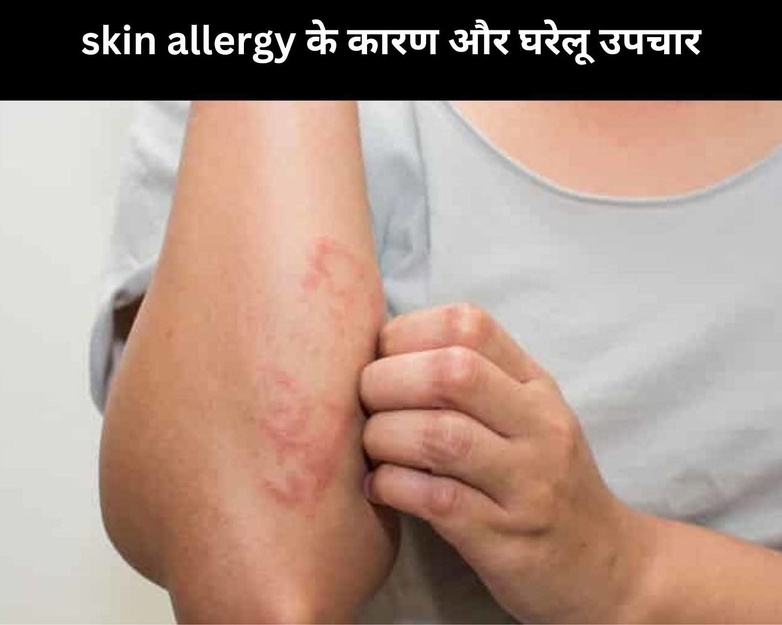 skin allergy के 4 कारण और 5 घरेलू उपचार (फोटो - sportskeedaहिन्दी)