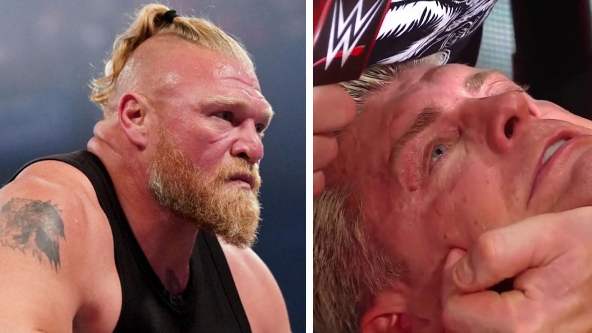Brock Lesnar injury How many stitches did Brock Lesnar get on his