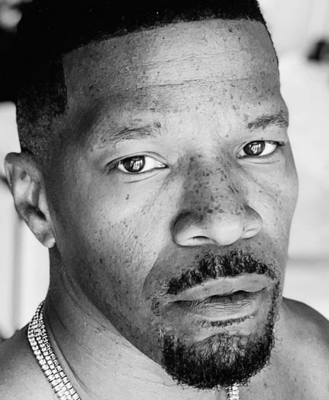 لم تفصح عائلته عن تفاصيله الطبية. (الصورة من IGiamjamiefoxx)