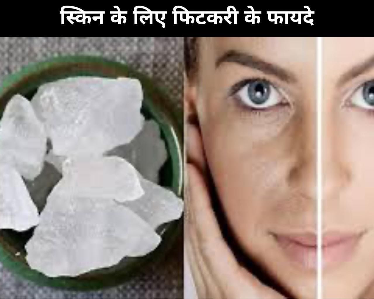 5 Benefits Of Alum For Skin In Hindi स्किन के लिए फिटकरी के 5 फायदे