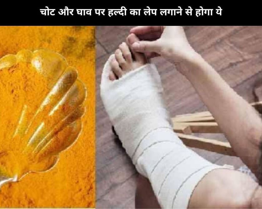 5 Benefits Of Turmeric For Wound Healing In Hindi चोट और घाव पर हल्दी